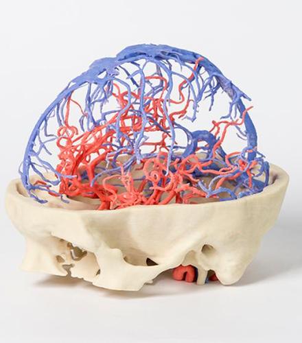 3D_두개골 동맥과 정맥의 순환(1640)