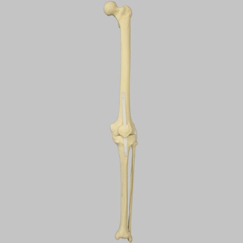 Sawbones 무릎 (1145-70)