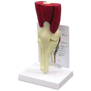 무릎관절/근육 (G106)