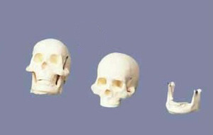 미니두개골 (GD0130)