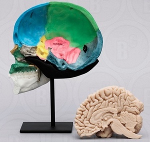 뇌 - 단면, 두개골포함 (267BC)