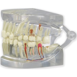 치아 - 투명 (G2861)