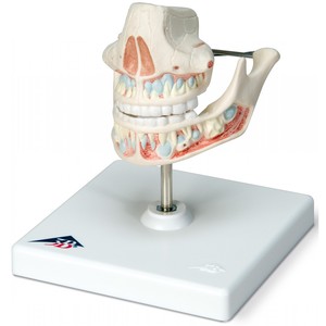 치아발달 - 젖니 (VE282)