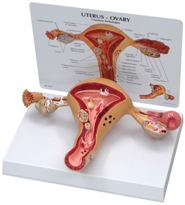여성생식기 - 자궁 (G348)