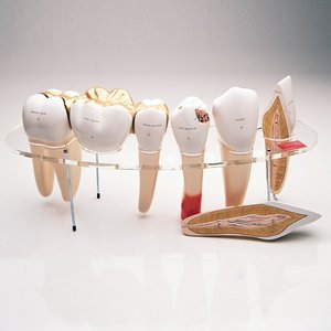 치아 - 10배확대 7분리 (W42517)