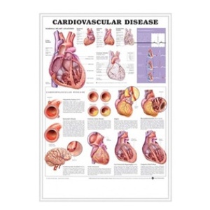 차트 - 입체, 심장혈관질환 (9915B)