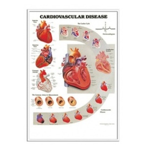 차트 - 입체, 심장혈관질환 (9915)